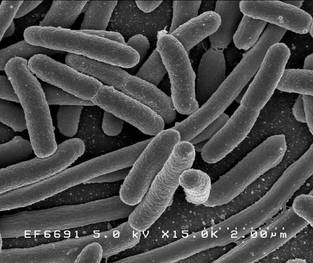 Escherichia coli (EHEC)
